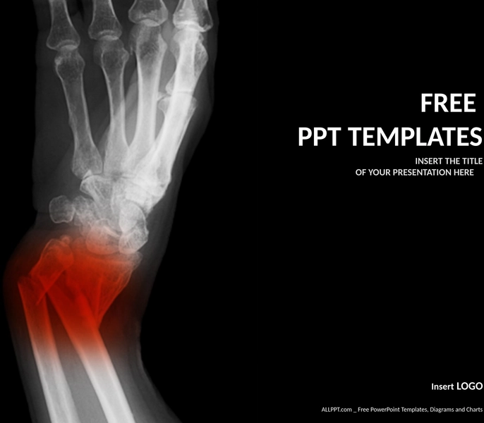 gebrochener-unterarm-medizinische-powerpoint-template-standard.png