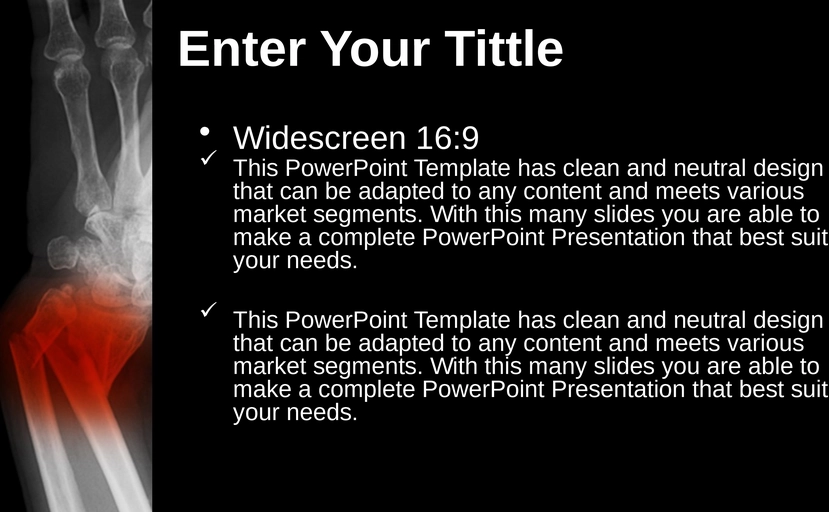 medizinische-praesentationen-knochenbrueche-powerpoint
